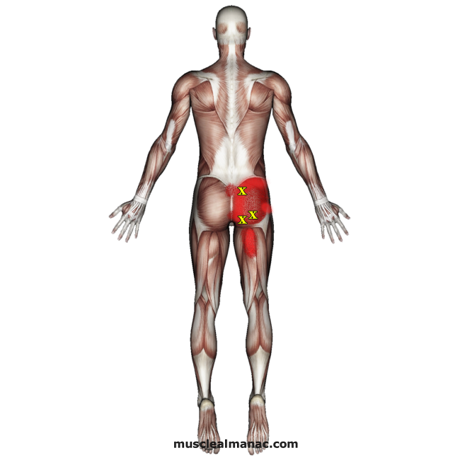 glute-max-trigger-point