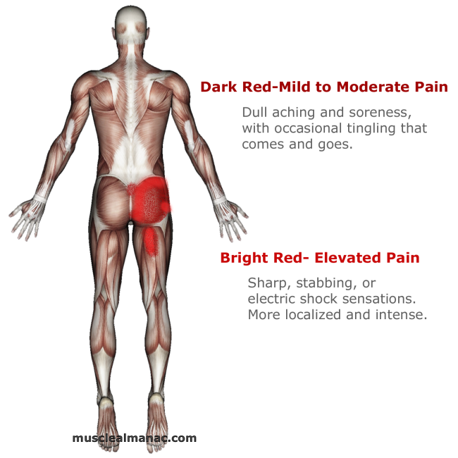 Image showing the gluteus